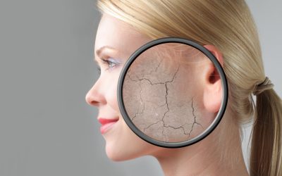 How Air Conditioning Affects Skin  